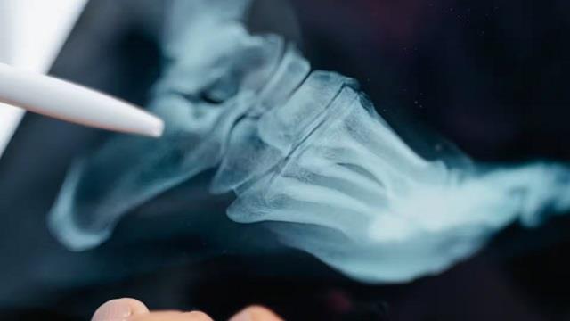 35 के बाद महिलाओं की हड्डियां क्यों हो जाती कमजोर?