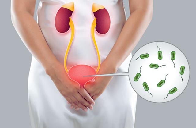 बार-बार UTI Infection हो जाती तो ये लापरवाही ना बरतें महिलाएं