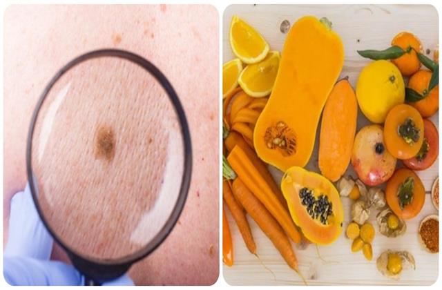 गर्मियों में तेजी से फैलता है Skin Cancer, इससे बचना है ताे खूब खाओ ये  Foods !