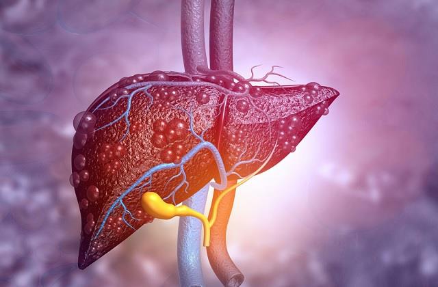 Liver Infection होने पर सबसे पहले Skin देती चेतावनी, ये लक्षण सामने आते