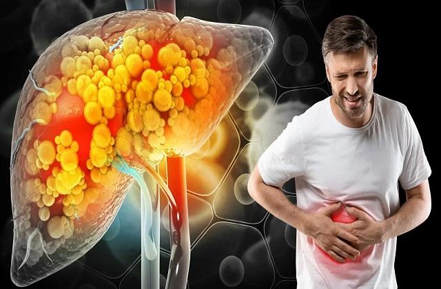 Fatty Liver को बिलकुल ठीक कर देती ये 6 सब्जियां, हफ्ते में दिखेगा आराम !