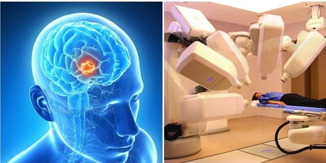 12 मिनट में ब्रेन ट्यूमर की पहचान करेगा AI सिस्टम, महंगे टेस्ट और लंबे इंतजार की जरूरत नहीं