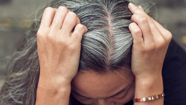 White Hair Causes: सिर्फ बढ़ती उम्र नहीं, इन 3 चीजों की कमी से भी जल्दी सफेद हो सकते हैं बाल