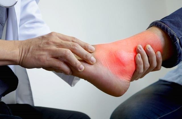 गर्मियों में बढ़ गया है Uric Acid तो डाइट में शामिल करें ये 5 फल, तुरंत मिलेगी राहत