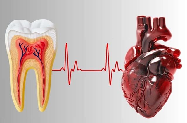 आपकी दिल के लिए खतरनाक है मसूड़ाें की बीमारी, चुपचाप करती है Heart पर Attack