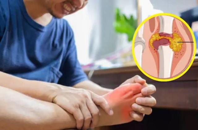 High Uric Acid  को कंट्रोल करने में मदद करेंगे ये 5 हेल्दी ड्रिंक्स