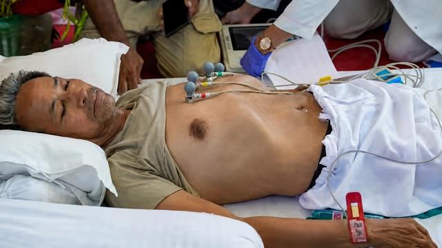 कितना वजन कम होना बन सकता है जानलेवा? समझें शरीर पर पड़ने वाला असर