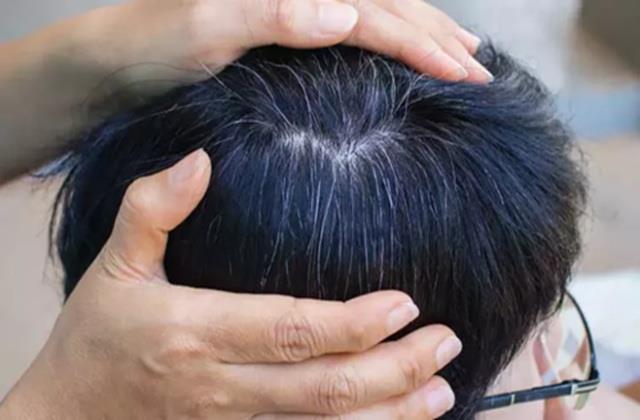 छोटी उम्र में बच्चे के के बाल हो गए सफेद? तो चैक करवा लो उनका Liver और Thyroid