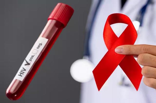 इस राज्य में बढ़ा HIV संक्रमण का खतरा, 66 हजार से ज्यादा चपेट में युवा आए