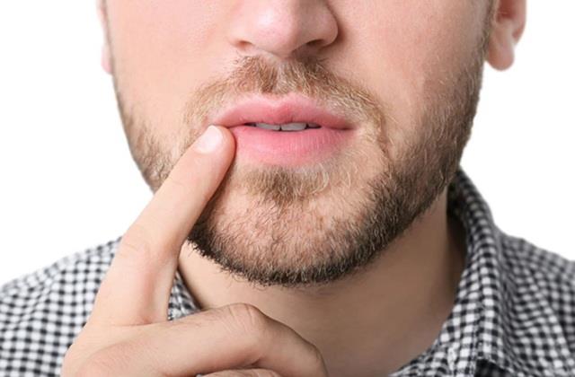 हमेशा तंबाकू की वजह से नहीं होता Lip Cancer, ज्यादा धूप में रहना भी है जानलेवा