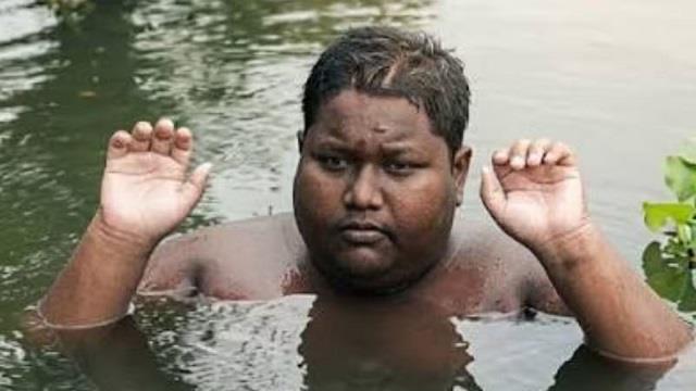 तालाब में रहने को मजबूर 16 साल का इकबाल, पानी से बाहर आते ही होती है तेज जलन