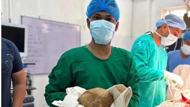 ब्रेन अटैक के इलाज के लिए पहुंचा था मरीज, ब्लैडर में मिली 3.1 किलो की पथरी; डॉक्टर भी रह गए हैरान