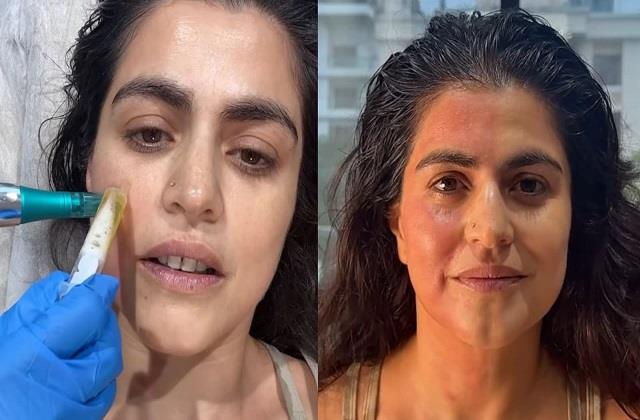 खून से किया जाता है Vampire Facial! एक्ट्रेस ने करवाया और बताया पूरा प्रोसीजर