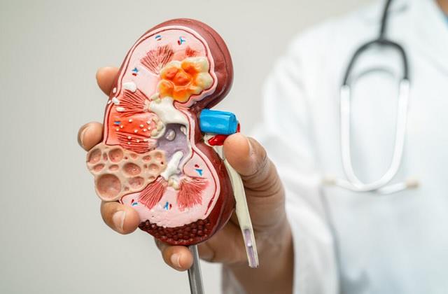 ये 7 गलतियां कर आप खुद ही कर रहे Kidney को धीरे-धीरे खराब