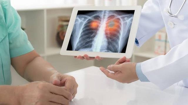 घर बैठे ऐसे रखें फेफड़ों को हेल्दी, रोज पिएं ये ड्रिंक