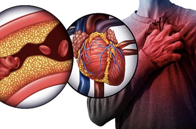 सीने में दर्द ही नहीं, ये लक्षण भी देते हैं दिल की धमनियों में ब्लॉकेज के संकेत