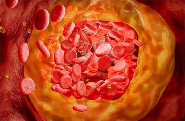 Cholesterol बढ़ने पर Body देती ये चेतावनी, इन संकेतों को इग्नोर ना करें तो अच्छा