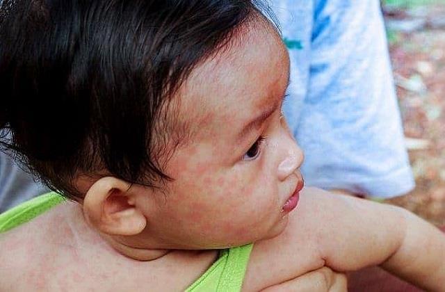 H1N1 वायरस के बाद अब इस नए वायरस का फैला खतरा, समय रहते पहचाने लक्षण