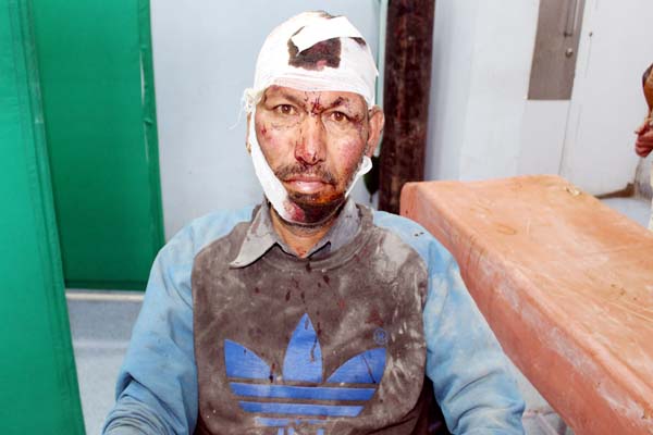 PunjabKesari, Injured Person Image